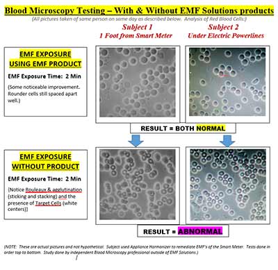 Chiropractic Torrance CA Blood Analysis